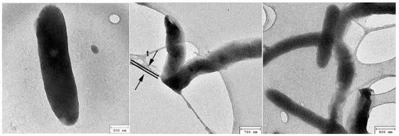 Figure 2: Dark rods under TEM (rearranged from Lo A et al., 2012).